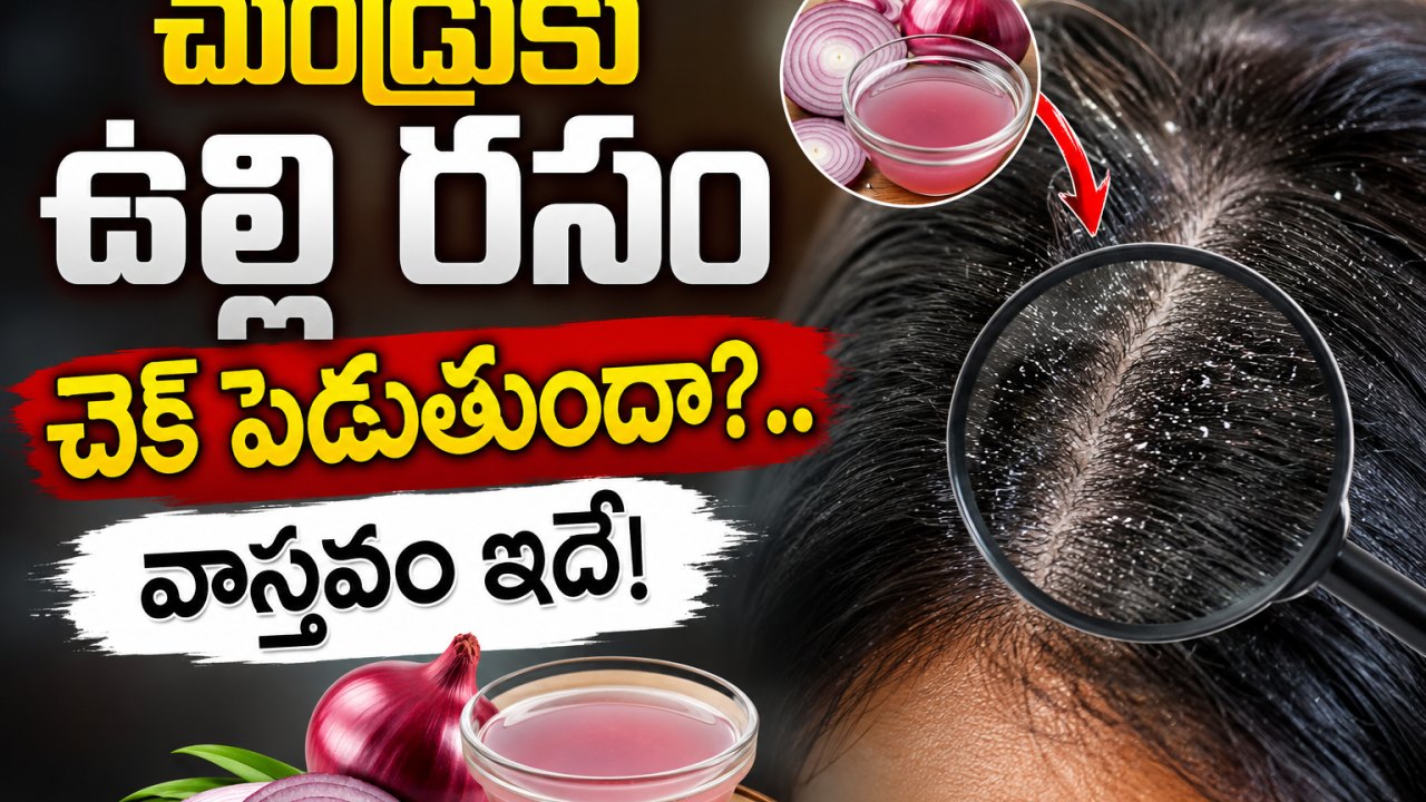 Health: చుండ్రుకు ఉల్లి రసం చెక్ పెడుతుందా?.. వాస్తవం ఇదే!