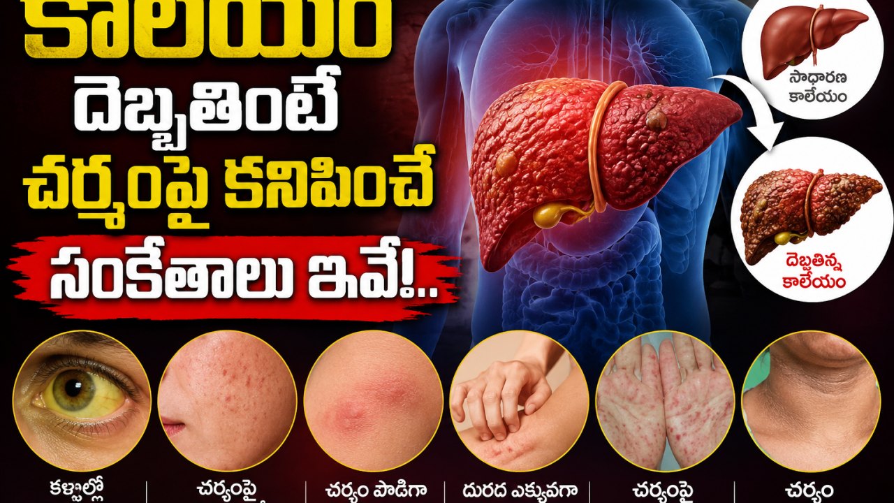 Health: కాలేయం దెబ్బతింటే చర్మంపై కనిపించే సంకేతాలు ఇవే!..