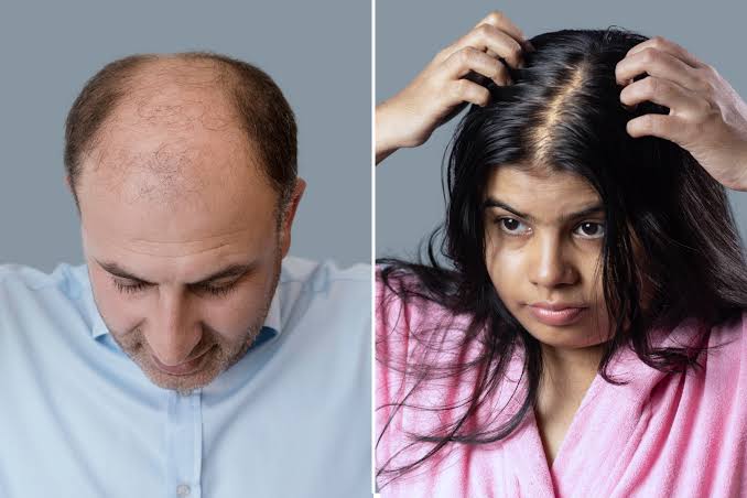 Health: విపరీతంగా జుట్టు రాలుతోందా? కారణం ఇదే కావచ్చు! బీ అలర్ట్..