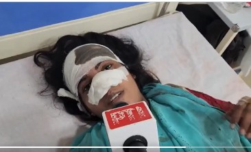 Viral : భార్య ముక్కు కొరికిన భర్త.. దీనివెనుక ఇంత స్టోరీ నడిచిందా?