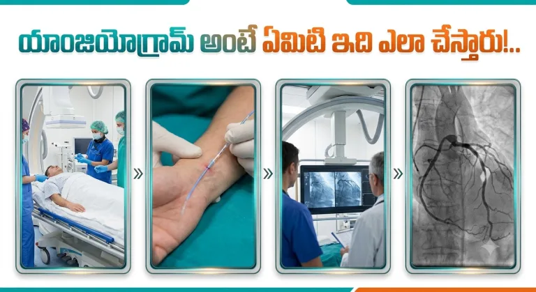 Health: యాంజియోగ్రామ్ అంటే ఏమిటి ఇది ఎలా చేస్తారు!..