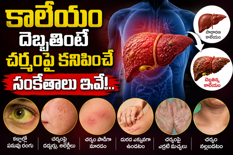Health: కాలేయం దెబ్బతింటే చర్మంపై కనిపించే సంకేతాలు ఇవే!..