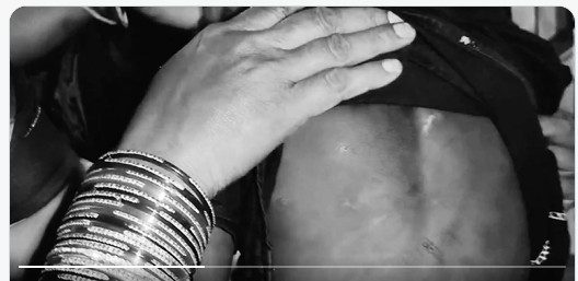 Crime : కన్నబిడ్డల పట్ల కర్కశత్వం.. ఒళ్లంతా వాతలు, కాలినగాయాలు!