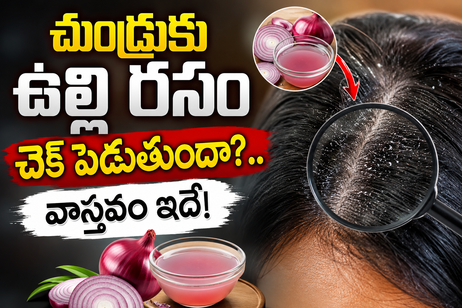 Health: చుండ్రుకు ఉల్లి రసం చెక్ పెడుతుందా?.. వాస్తవం ఇదే!