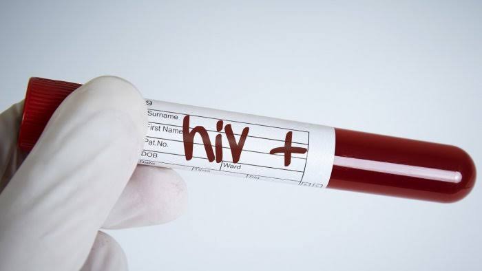 HIV :  ఆ రాష్ట్రంలో ఘోరం.. 7 వేల మంది విద్యార్థులకు HIV పాజిటివ్!