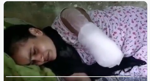 Viral : చెవి నొప్పిగా ఉందని వెళితే.. ఏకంగా చెయ్యి పోయింది? (వైరల్)
